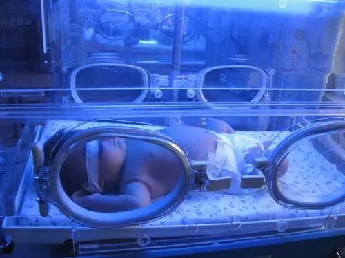 新生儿黄疸超标的症状及危害,新生儿黄疸超标怎么办