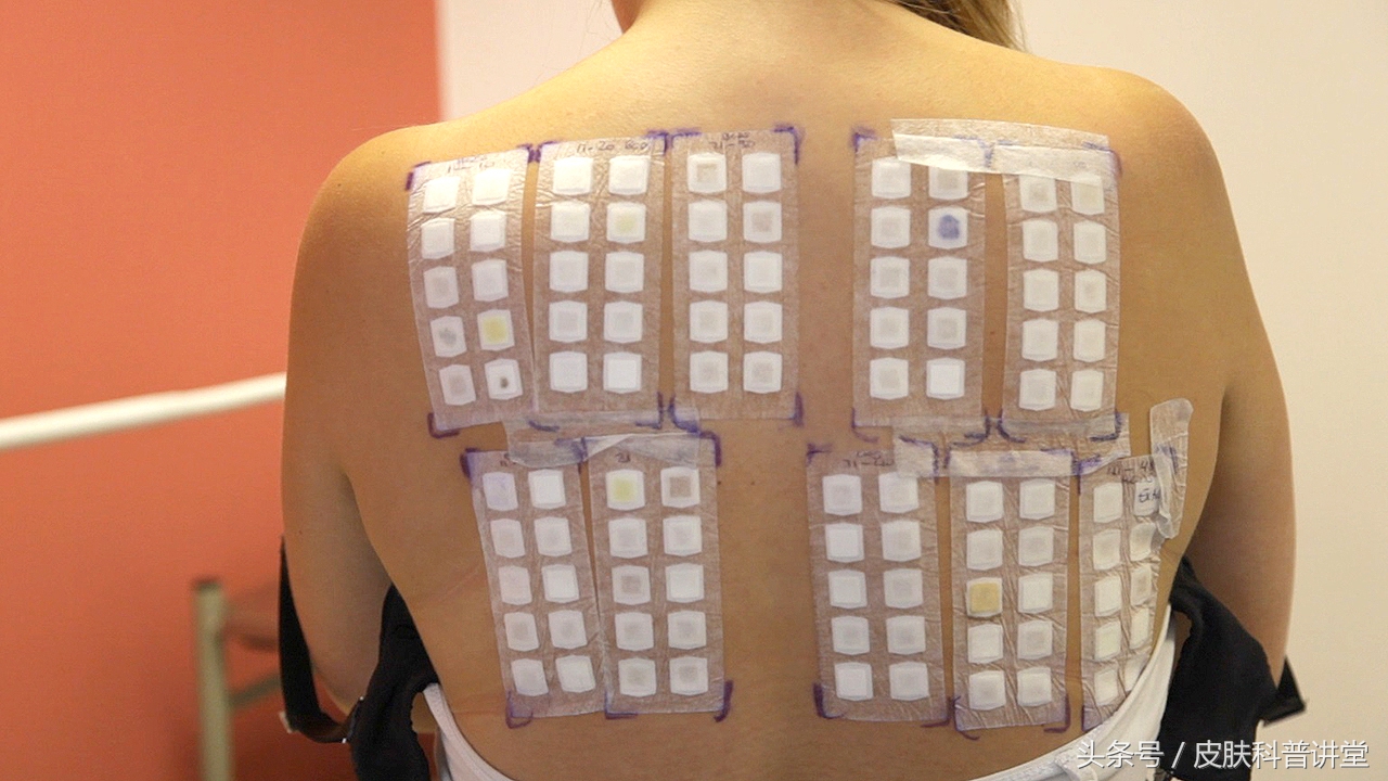 反复过敏要警惕,反复过敏但测过敏源不过敏