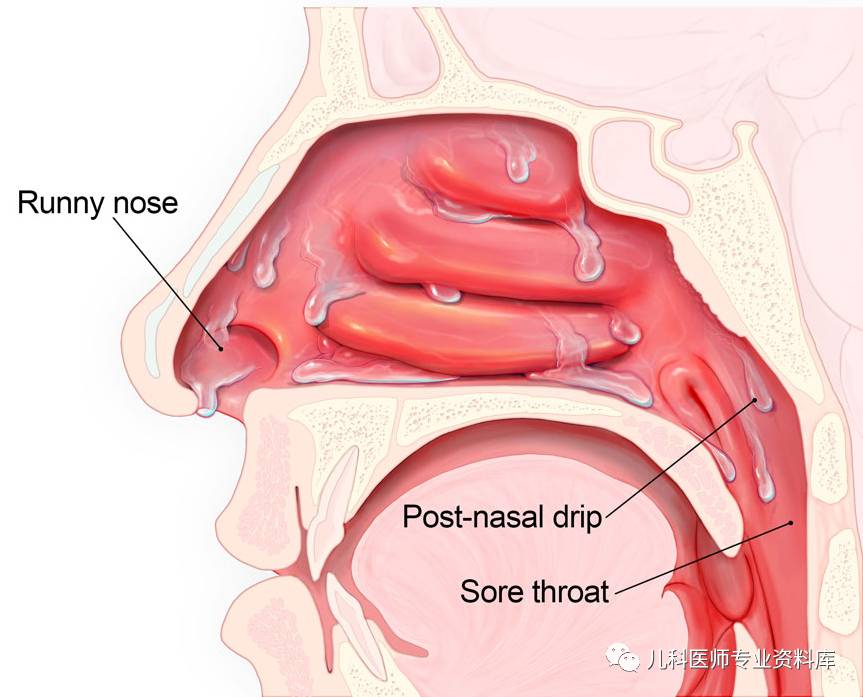 儿童鼻涕的秘密,儿童黄鼻涕粘稠