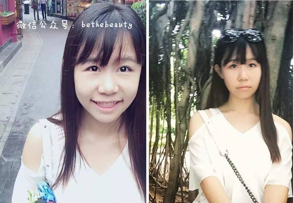 鼻子除了整容变挺还有什么办法,不想整容怎么让鼻子好看