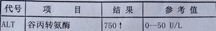 肝功能检查都正常就谷丙转氨酶高,谷丙转氨酶319.3谷草转氨酶152.6
