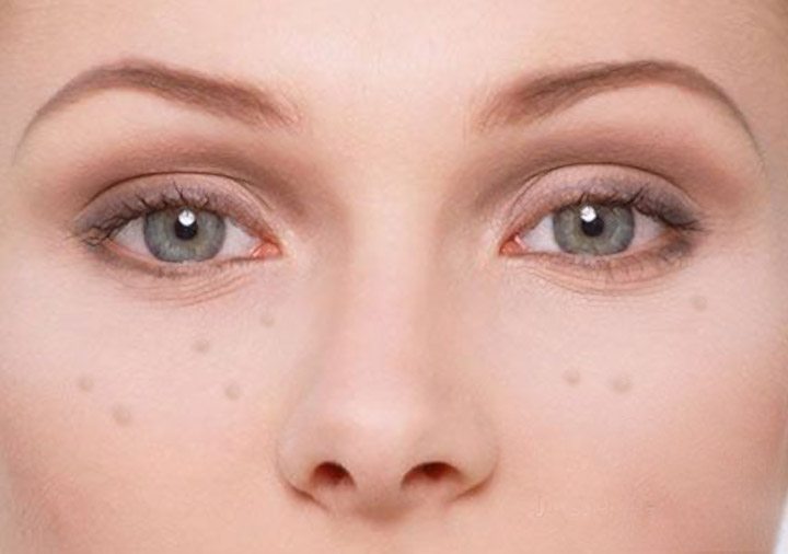 脸上频繁长脂肪粒怎么办,脸上长满脂肪粒怎么办