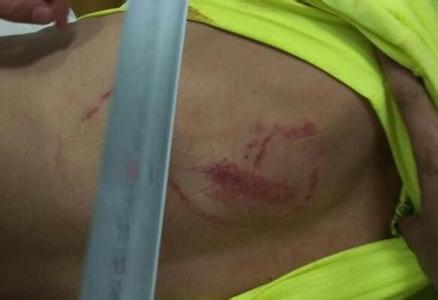 中超权健冲突,长春亚泰打架事件最新