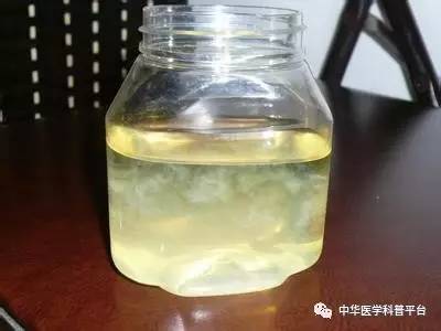 看尿液颜色判断身体有多少水,通过尿液颜色也能辨健康