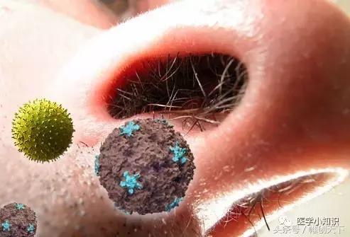 鼻窦炎引起头痛怎么治疗,鼻窦炎的症状及食疗视频播放