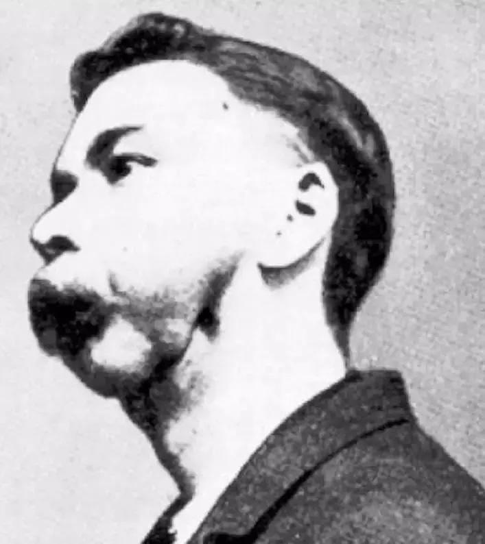 这种物质曾被当作保健成分,受害者的遗骨因此发光上千年