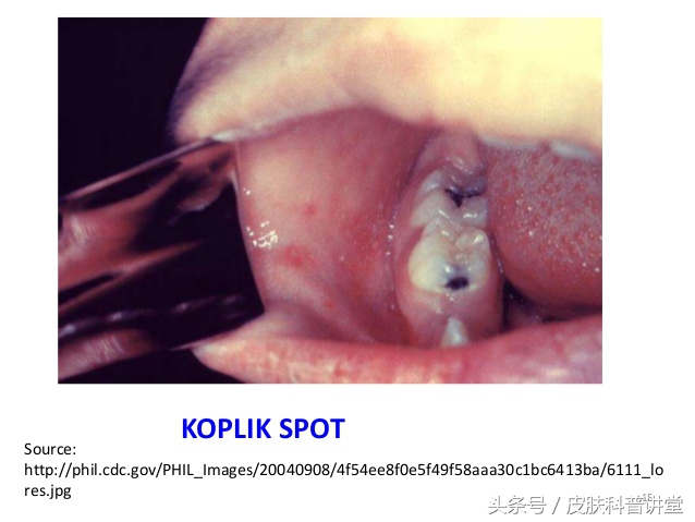 皮肤科普健康知识讲座,皮肤科普视频