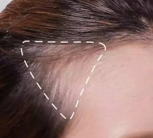 大幂幂被吐槽发际线高,大幂幂发际线效果图