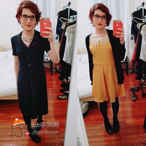 秃头大叔服用雌性激素,秃头男吃雌激素一年