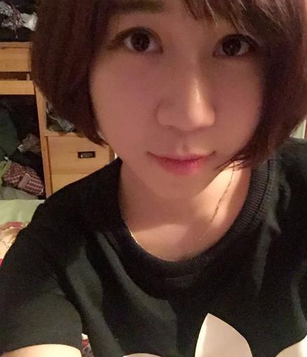 韩式三点双眼皮恢复单眼皮,韩式三点式双眼皮是永久性的吗