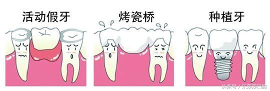 镶牙真的是一种错误吗,镶牙很假吗