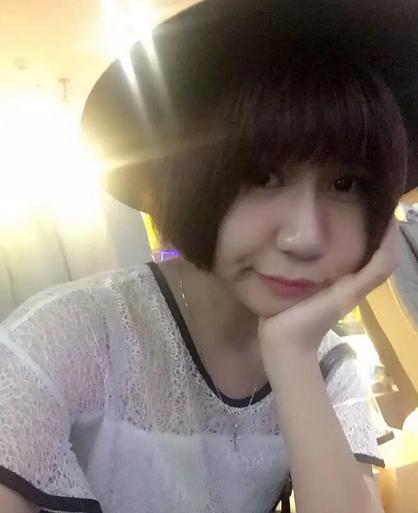 韩式三点双眼皮恢复单眼皮,韩式三点式双眼皮是永久性的吗