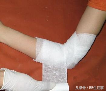 儿童发生烫伤烧伤采取的急救措施,如被烫伤或烧伤急救措施应怎样做