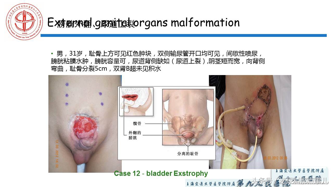 泌尿男科王忠教授,泌尿外科专家王忠教授
