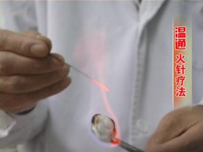 梅花针三棱针,三棱针常用针法