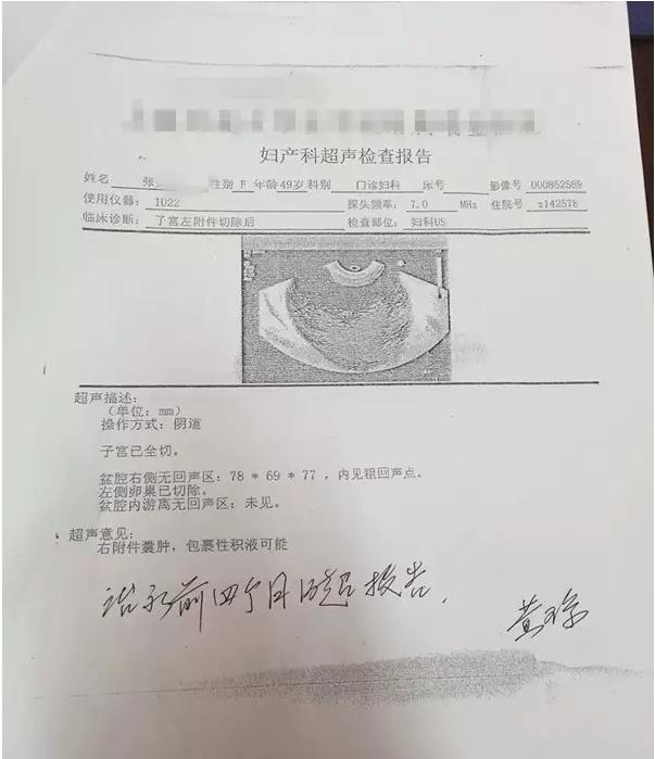 肌瘤消除方法,肌瘤调理效果图