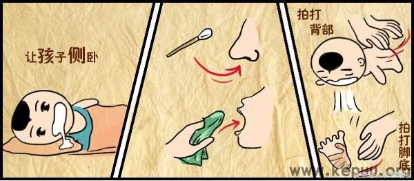 新生儿呛奶窒息急救法,婴儿呛奶窒息的紧急处理方法