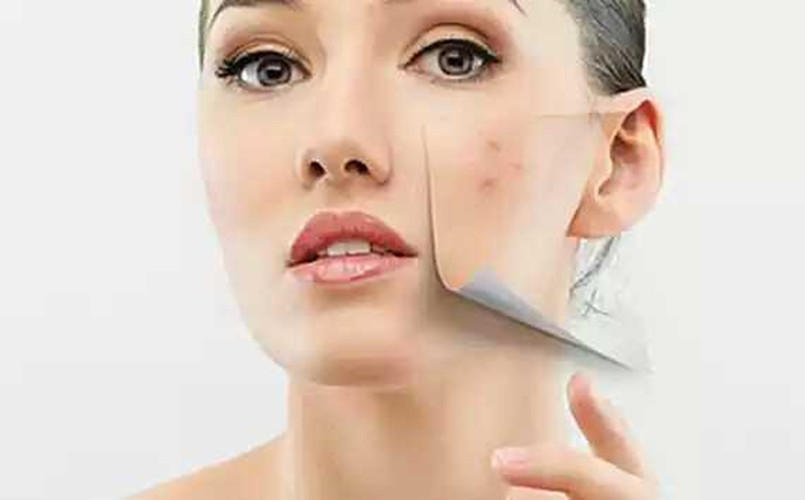 你为什么一直长痘痘呢？你也许忽略了这些