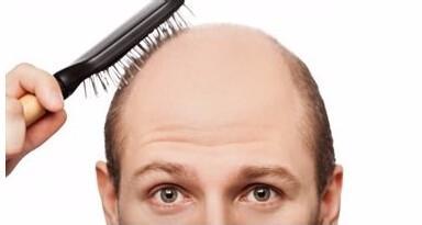 年轻人脱发的原因有什么食疗办法,年轻人脱发有白头发是什么原因