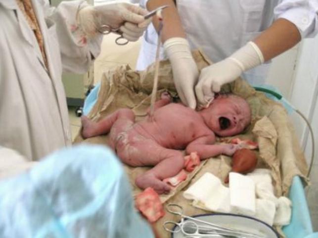 生孩子紧急情况及措施,生孩子不顺利怎么回事