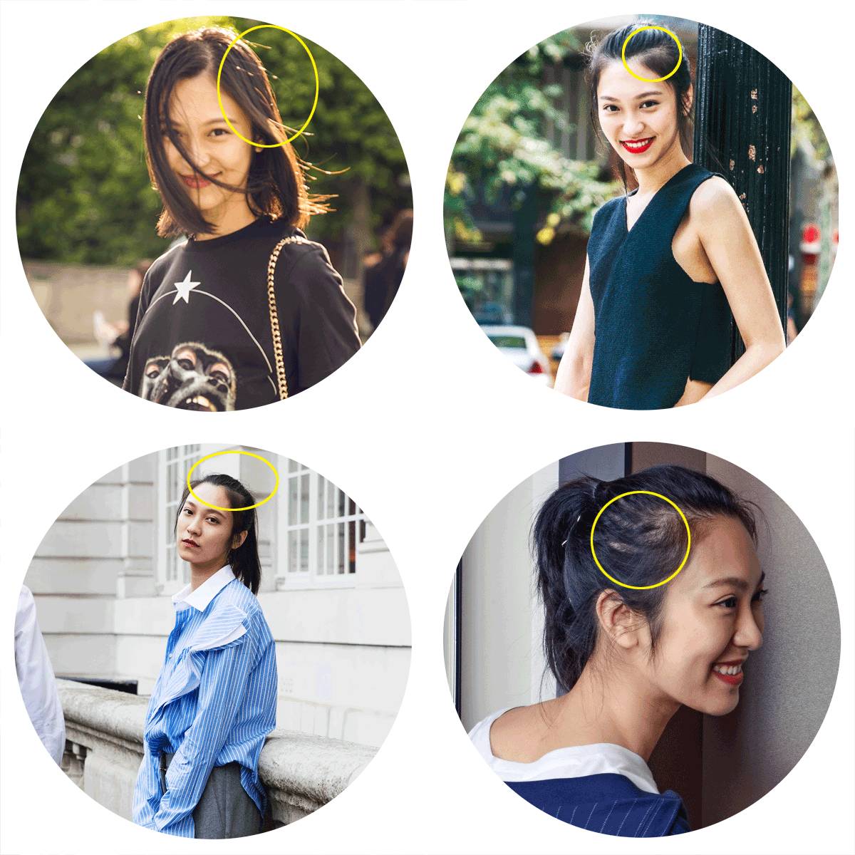 我的发际线我该拿什么拯救你,拿什么拯救你我的发际线