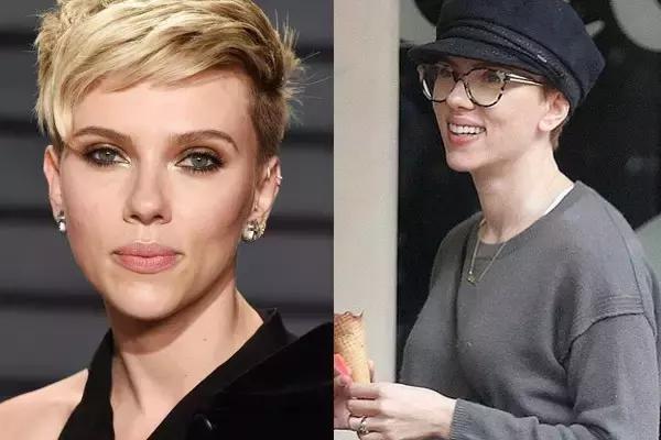 毛孔粗大痘印暗沉怎么修复,毛孔痘印怎么消除最快