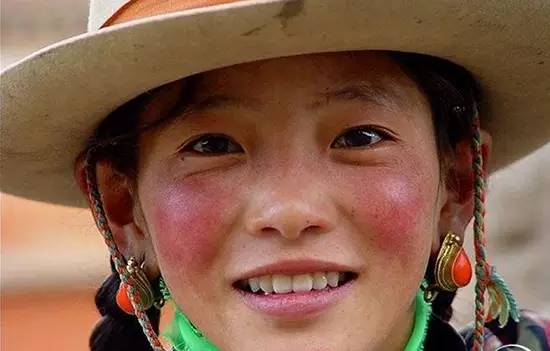 红血丝很好治的亲身经历过,我的血有一点暗红是什么原因