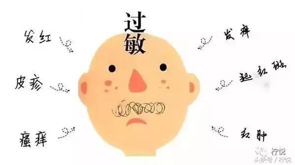 舒淇经常过敏,舒淇过敏好了吗