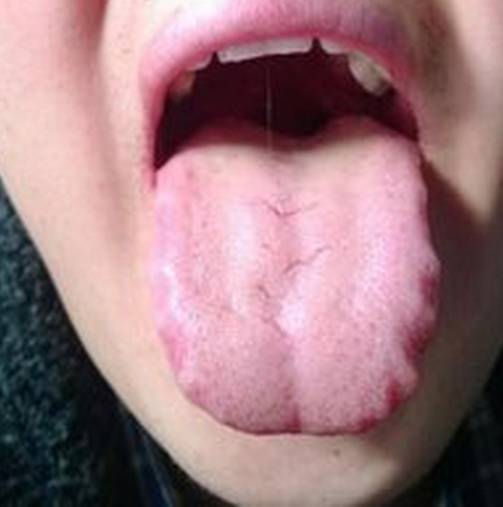 体内湿气危害太大，有多少个雷区被你踩到了