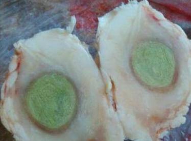 男子杀猪竟收获猪宝,男子杀猪获得猪宝