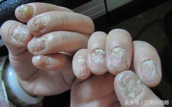 抗真菌药学习教学视频,零基础学药学课程