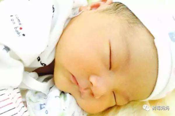 你家宝宝“黄”吗？胆红素多少要警惕病理性黄疸？