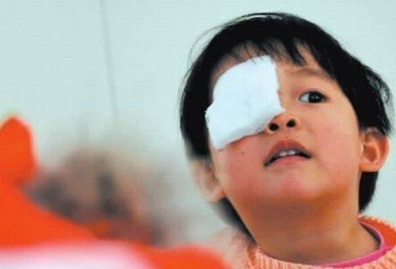 麦粒肿反复可能是癌症,孩子长麦粒肿怎么办