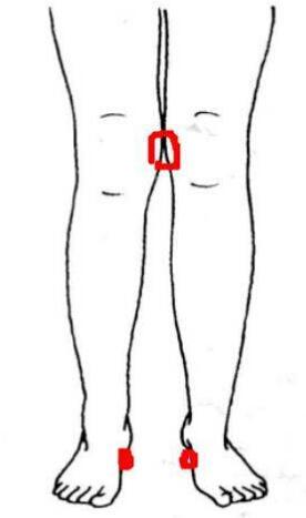 腿不直怎么矫正腿型未成年,大腿向前凸起矫正最实用的办法