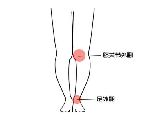 腿不直怎么矫正腿型未成年,大腿向前凸起矫正最实用的办法