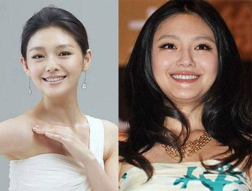 埋线减肥后怎样才能不反弹,埋线减肥肚子反而更大了