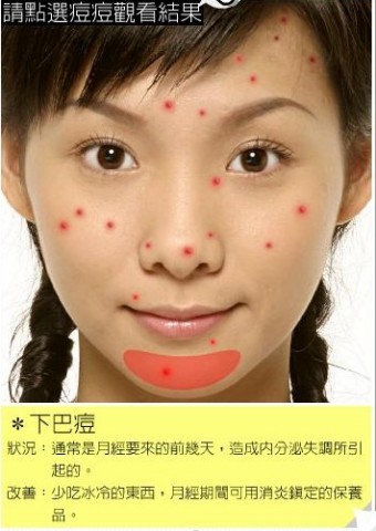 4招正确区分痘痘粉刺,粉刺是痘痘初期状态吗