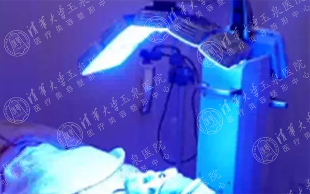 分享我的4年战痘经验,战痘能手护肤常识