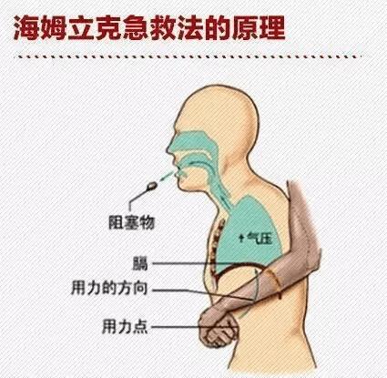 吃东西噎着了怎么办,食道癌吃东西噎着了该怎么办