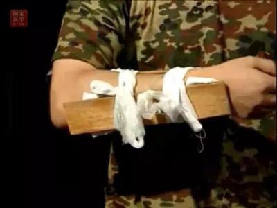 倒霉孩子骨折,倒霉透了手骨折