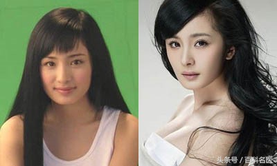 四种人矫正牙齿脸型变化是最大的,牙齿畸形矫正图片大全