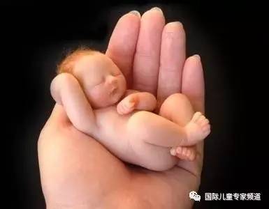 新生儿血肿骨化可以消掉吗,头颅血肿骨化对宝宝有影响吗