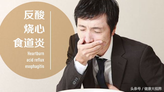 反流性食管炎胃炎中药有哪些,反流性食管炎反酸中药