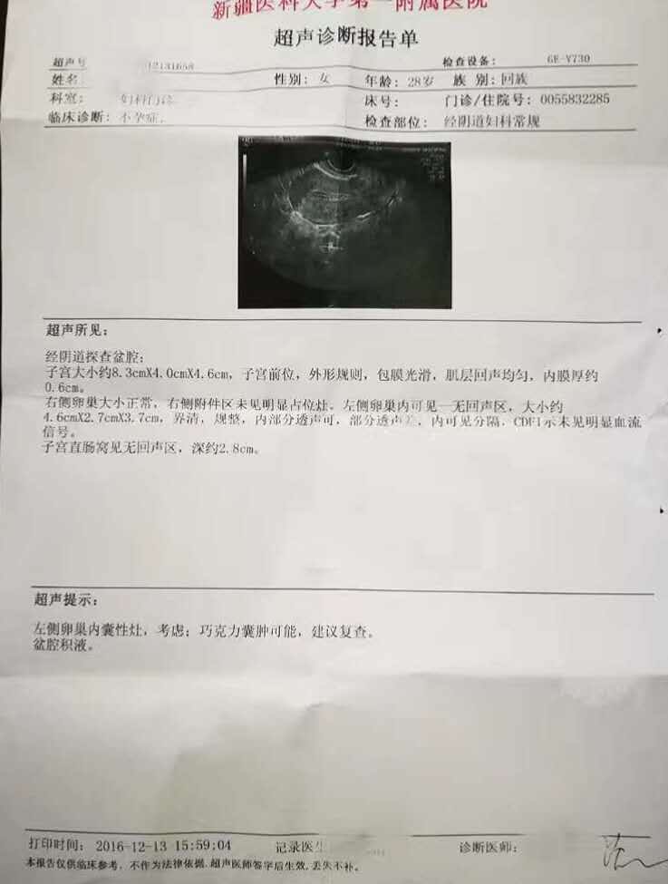 盆腔积液会导致巧克力囊肿吗,巧克力囊肿和盆腔积液怎么治疗