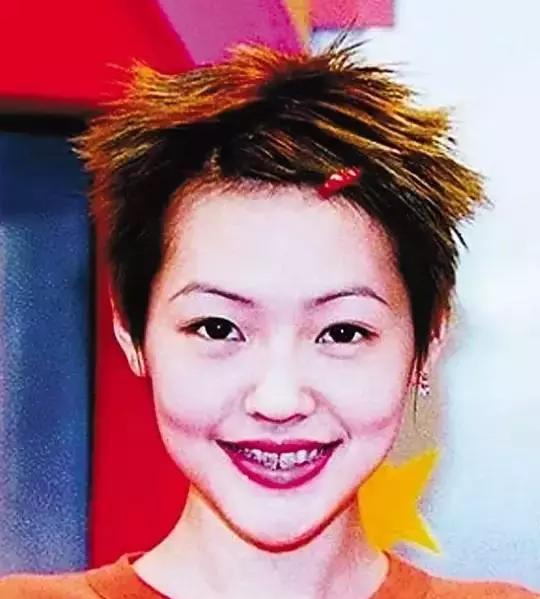 有多少明星整了鼻子,整过的明星有哪些