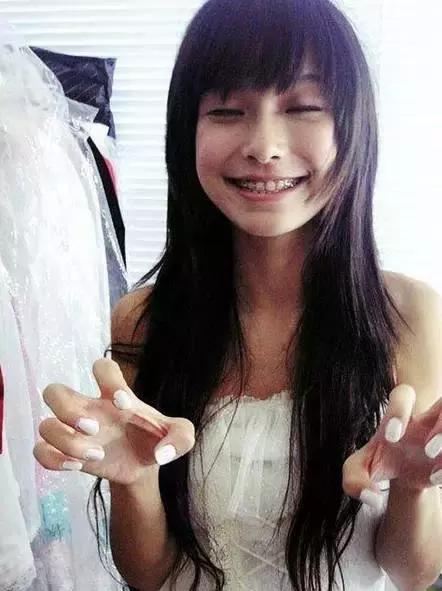 有多少明星整了鼻子,整过的明星有哪些