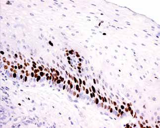 内镜做病理分析大概多久,作为一个医生太感性怎么办