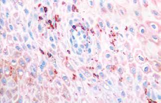 内镜做病理分析大概多久,作为一个医生太感性怎么办