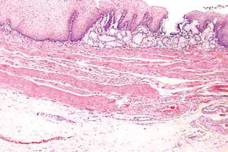 内镜做病理分析大概多久,作为一个医生太感性怎么办