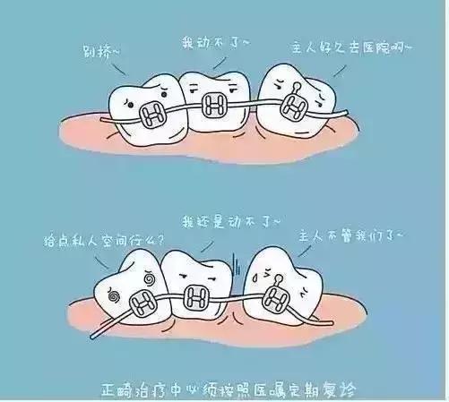 牙齿矫正打骨钉后注意事项,牙齿矫正需要注意的事项